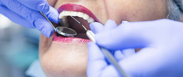 Best Pediatric Emergency Dentist in Clayco, MO